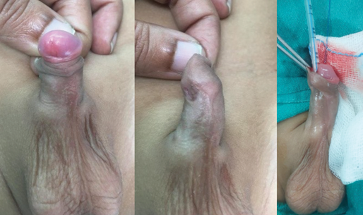 A person with a red mark on their finger.

Description generated by AI