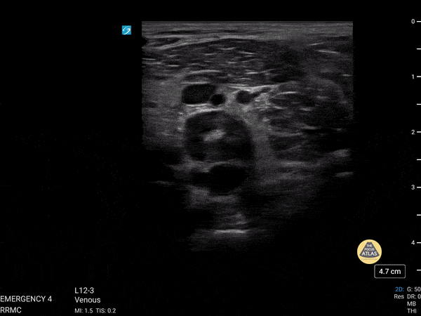 A black and white image of a baby.

Description generated by AI