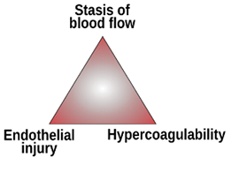 A red triangle with a black background.

Description generated by AI