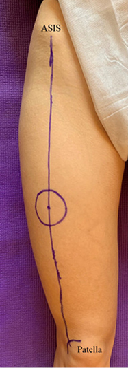 patella-1.jpg