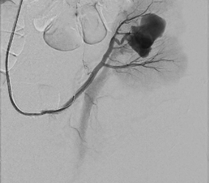 renal-36.png