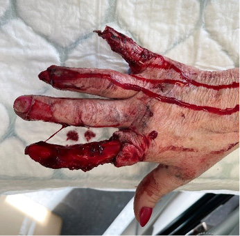 preop-21.jpg