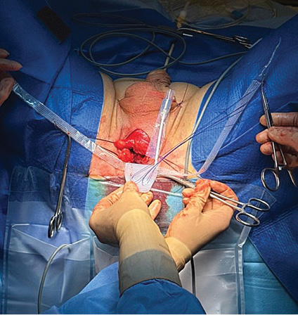 implant-15.jpg