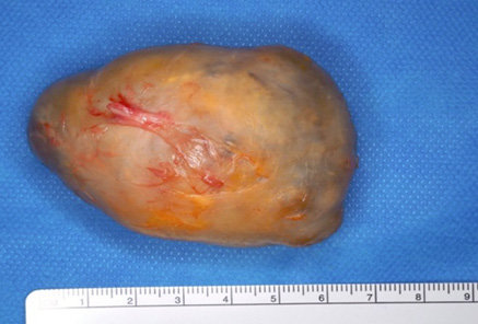 A piece of meat with a blue cloth underneath it.

Description generated by AI
