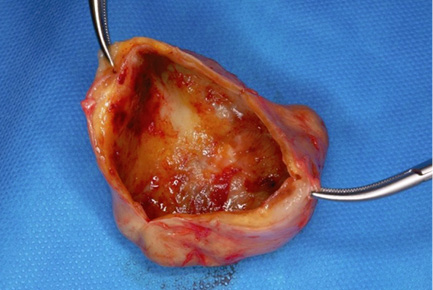 A piece of meat with a hook in it.

Description generated by AI