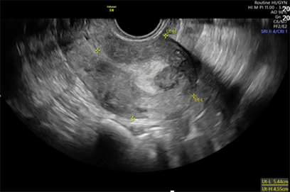 A black and white image of a pregnant woman.

Description generated by AI