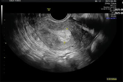 A black and white image of a pregnant woman.

Description generated by AI